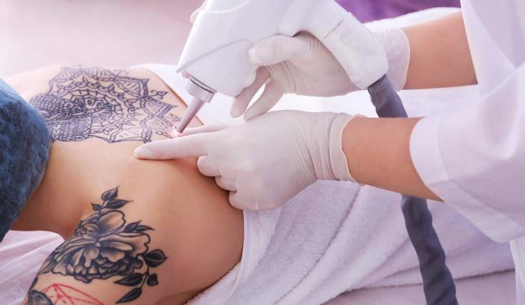 New Look Tattoo Gallery in Rohini Sector 3Delhi  Best Tattoo Removal  Services in Delhi  Justdial